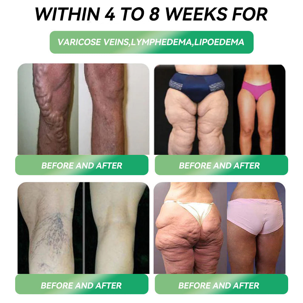 Extra 30% off on sale items! | Lercea®🌿𝐺𝐿𝑃-1 𝑊𝑒𝑖𝑔ℎ𝑡 𝐿𝑜𝑠𝑠 𝑂𝑟𝑎𝑙 𝑆𝑜𝑙𝑢𝑡𝑖𝑜𝑛, visible changes in 7 days 🌿 For obesity, cardiovascular health, diabetes, sleep apnea, joint issues, and more
