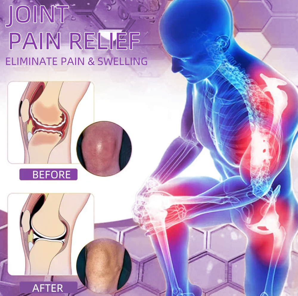 Official Store: TLOPA® Shark Cartilage Pain Relief Bone Recovery Gel 🔥Limited time offer, enjoy 30% off the second item again